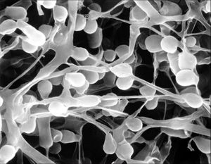 족부백선의 현미경 사진