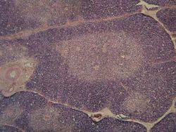 현미경 사진으로 본 가슴샘 소엽. 짙은 보라색의 피질(바깥쪽)이 옅은 색의 수질(안쪽)을 둘러싸고 있다.