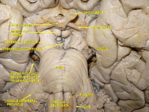 대뇌(깊은 하단 해부)