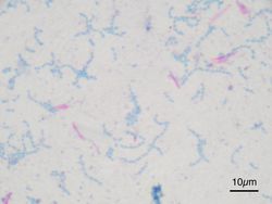 항산 염색 (칠-닐슨법)항산균은 분홍색으로, 그 외 세균은 파란색으로 염색된다.