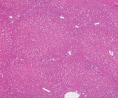 간의 조직학 이미지(소엽 구조).