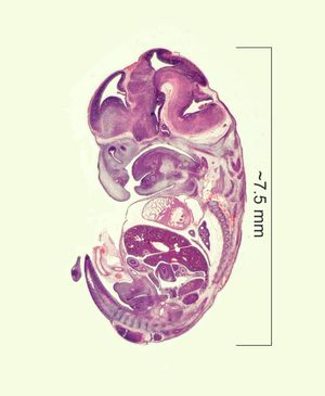 10일 된 쥐의 배아