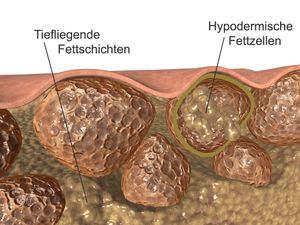  단면도. 구형의 것이 지방 세포.