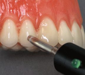 전기 치수 검사기