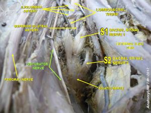 폐쇄 신경(녹색)은, 넙다리 신경(FEMORAL NERVE, 왼쪽)이나 좌골 신경(SCIATIC NERVE, 오른쪽)에 비해 가늘다.