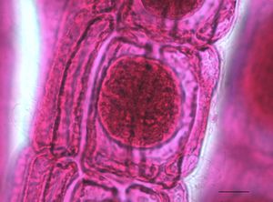 6. 이토구사속 (이기스목)의 사분포자낭.