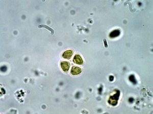 테트라스트룸}} (클로렐라목).