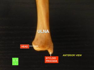 척골 주두돌기 - 원위단, 전면상