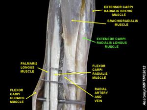 긴노쪽손목폄근