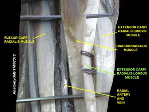 긴노쪽손목폄근