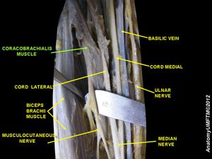 부리위팔근 (초록색 글씨로 표시)