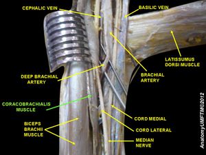 부리위팔근 (초록색 글씨로 표시)