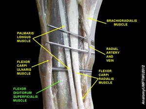 얕은손가락굽힘근