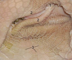 양의 제2위(벌집위)