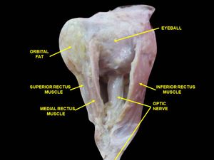 바깥눈근육과 눈확의 신경. 깊은 해부.