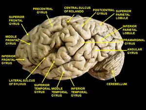 대뇌 측면도 (깊은 해부)