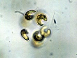 1c. 팔멜라상 군체성 키르크네리에라 속 (요코와미도목)