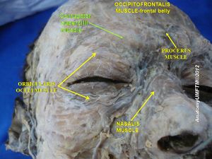 눈썹주름근(녹색 글씨로 쓰여진 부분)