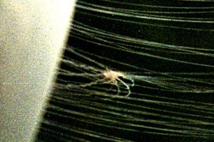 ecoSCOPE로 촬영한 이미지로, 사냥감이 코르크 마개 모양으로 섬유를 수축하여 몸으로 끌려가는 모습