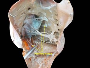 깊은 곳까지 해부하여 꼭지근이 보이게 한 사진.