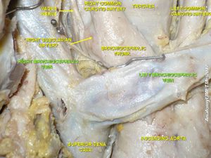 오른쪽 팔머리정맥.