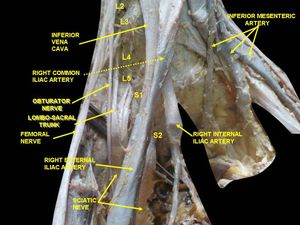 허리엉치신경얼기 깊은부분 해부.