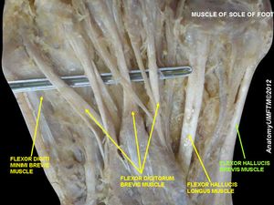 짧은엄지굽힘근 (발)