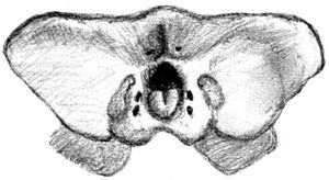 켈렌켄 완모식 두개골 스케치 (뒤쪽)