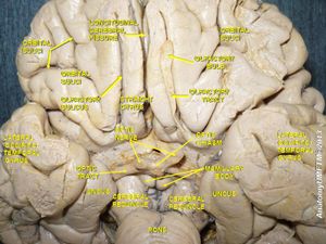후각 신경, 심부 해부, 아래쪽 시야