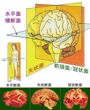 인간대뇌에서의 평면.
